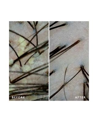 Scalp Remedy Conditioner 6.7 oz.