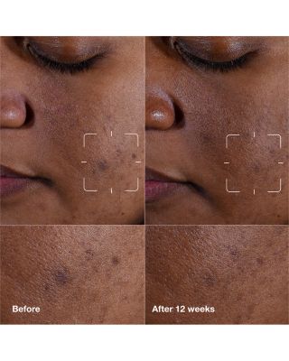 Even Better Clinical Dark Spot Clearing Serum with Vitamin C 1.7 oz.