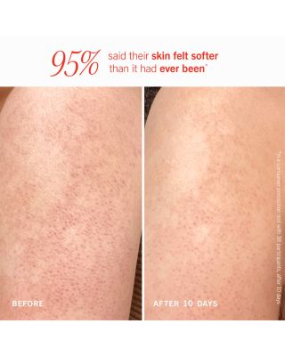 KP Bump Eraser Body Scrub with 10% AHA - Fresh Peach 8 oz.