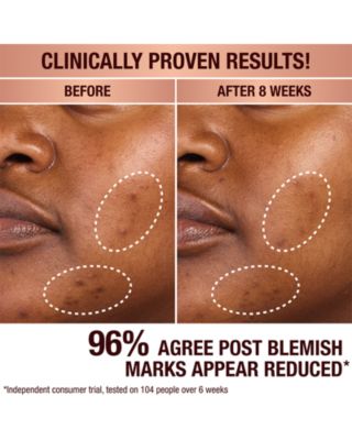 Dark Spot Correcting Radiance Recovery Serum 0.34 oz.