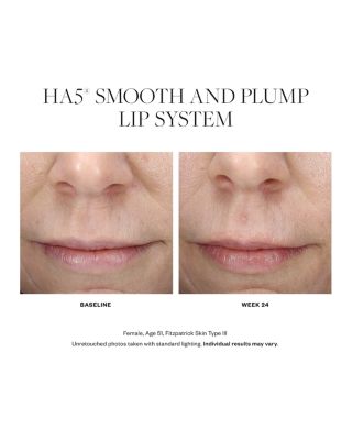 HA5 Smooth & Plump Lip System