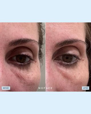 Trinity All In One Kit ($785 value)