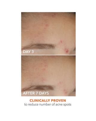 Alpha Beta On The Spot Eliminator 1 oz.