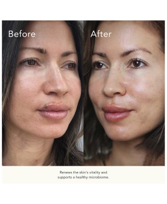 pH+ Enzyme Essence 3.4 oz.