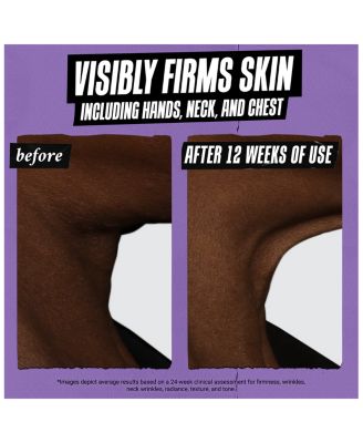 Retinol Skin-Renewing Daily Micro-Dose Serum 1.7 oz.