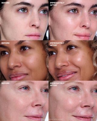 Collagen Skinjection Plumping & Firming Serum 1 oz.