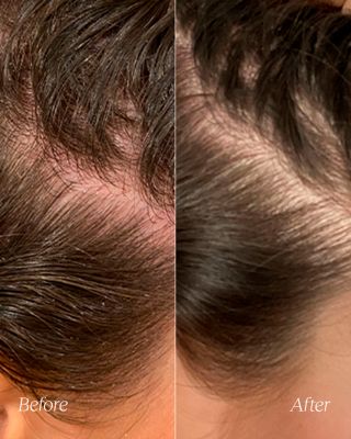 Hydrate & Soothe Scalp Serum 1.7 oz.