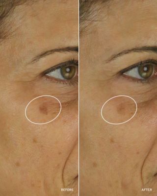 NAD+ Cell Energizing Treatment 1.7 oz.