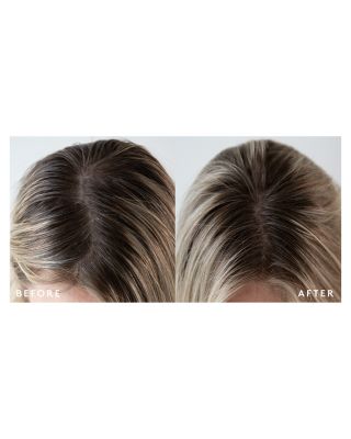 Topical Scalp Supplement 2 oz.