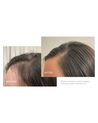 Flourish Hair Growth Treatment Set