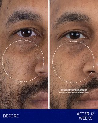 The Serum Full Pack 1 oz.