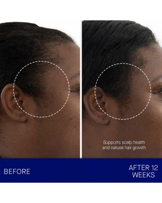 The Scalp Treatment 1 oz.