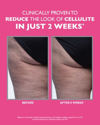 FIRMx Tight &amp; Toned Body Treatment 3.4 oz.