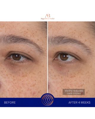 The Eye Patches, Pack of 6