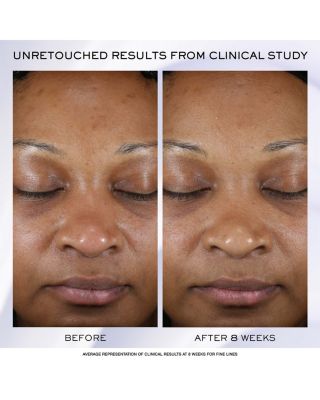 R&eacute;nergie H.P.N. 300-Peptide Anti-Aging Cream 1.7 oz.