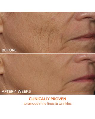 DRx SpectraLite™ Faceware Pro