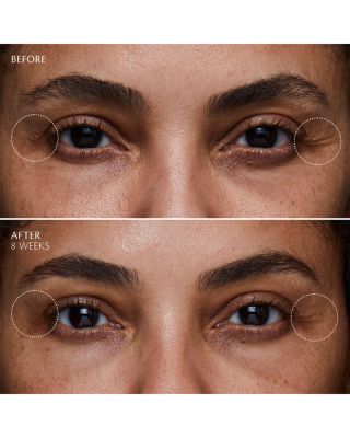 EMBEAGE Empyrean Eye アイクリーム アンべアージュ🌼スゴいアイクリーム発売｜カナリヤ本店