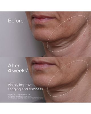 Future Solution LX Regenerating Cream Set ($437 value)