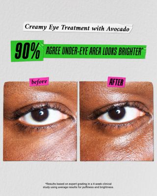 Creamy Eye Treatment with Avocado Duo ($120 value)