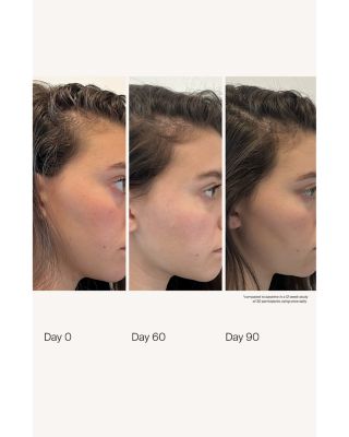 Scalp Care Density Serum 1.7 oz.