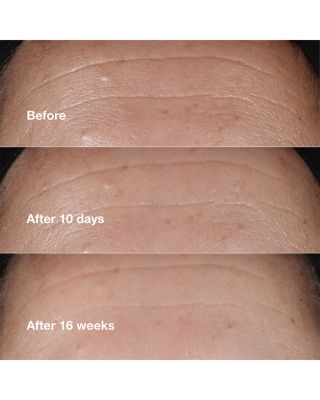 Smart Clinical Repair Wrinkle Correcting Serum 1 oz.