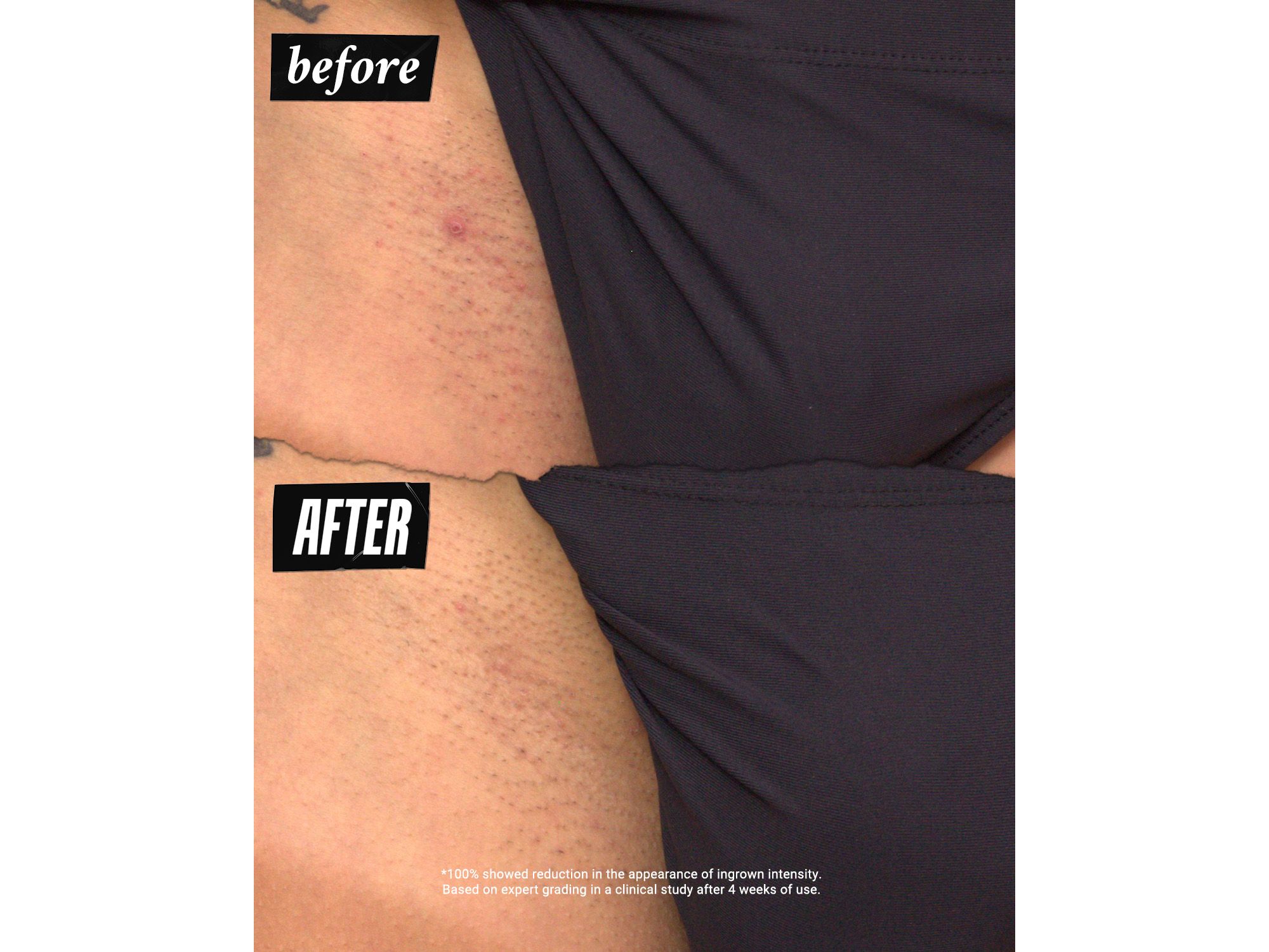 Ingrown Hair & Tone Correcting Intimate Drops 1 oz. — Image 8