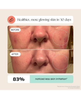 Bedside Humidifer 2.0