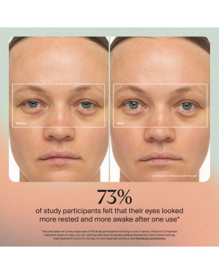 TheraFace Depuffing Wand