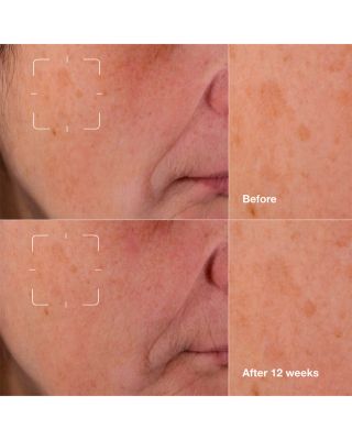 Even Better Clinical Dark Spot Clearing Serum with Vitamin C 1.7 oz.