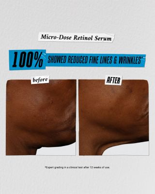 Kiehl&#39;s Since 1851 Hydrate, Treat, &amp; Repeat Skincare Gift Set ($140 value)