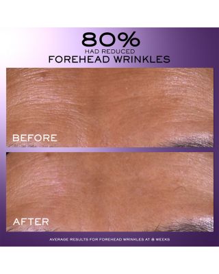 R&eacute;nergie C.R.x. Triple Serum Retinol 1.7 oz.