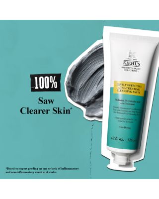 Gently Effective Acne Treating Cleansing Paste 4.2 oz.