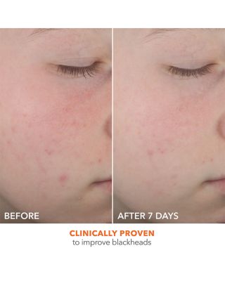 Alpha Beta On The Spot Eliminator 1 oz.