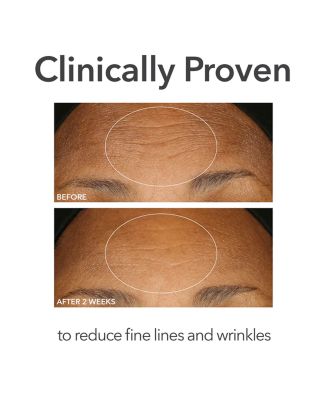 Alpha Beta Extra Strength Daily Peel, 5 Pads