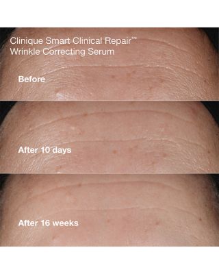 Wrinkle Fighting Routine Skincare Set ($129 value)