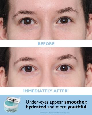 Full Size Vitamin C & Hyaluronic Eye Patches Kit  ($120 value)