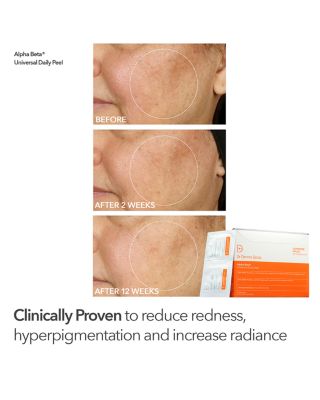 The Peel Vault ($245 value)