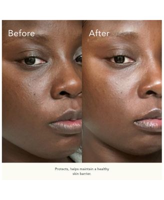 KB5™ Calming Gel Cleanser 4.4 oz.