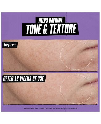 Retinol Skin-Renewing Daily Micro-Dose Serum 1.7 oz.