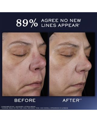 G&eacute;nifique Ultimate Recovery Serum Home & Away Gift Set ($224 value)