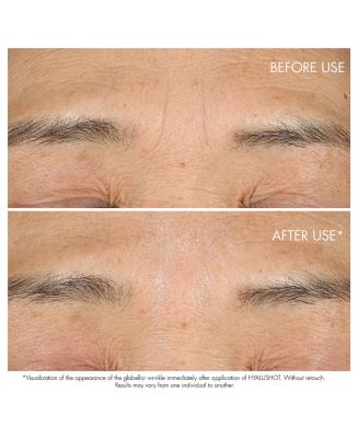 Capture Totale Hyalushot Wrinkle Corrector With Hyaluronic Acid 0.5 oz.