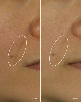 NAD+ Cell Energizing Treatment 1.7 oz.