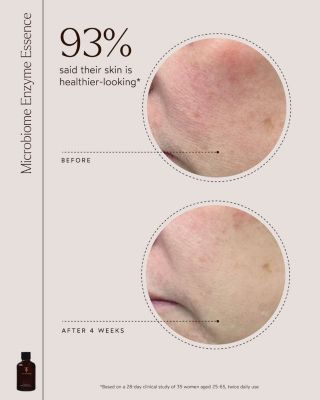 Microbiome Enzyme Essence 4 oz.