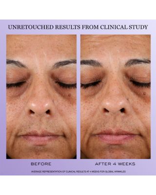 R&eacute;nergie Mother's Day Skincare Gift Set ($277 value)